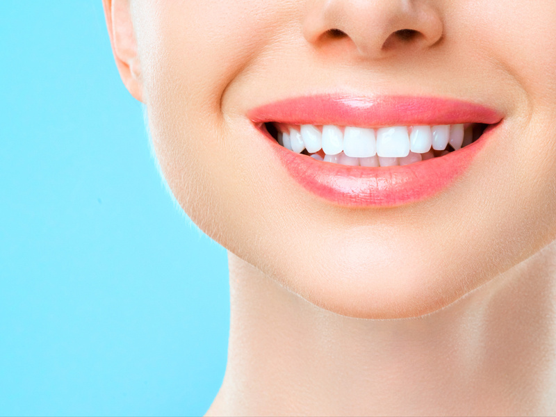 Λεύκανση δοντιών: Όλα όσα πρέπει να γνωρίζετε 
