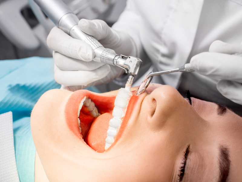 Πέτρα στα δόντια: Πρόληψη και αντιμετώπιση