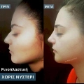 Φωτογραφίες