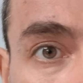 Φωτογραφίες