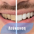 Φωτογραφίες