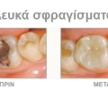 Φωτογραφίες