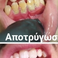 Φωτογραφίες