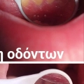 Φωτογραφίες