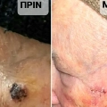 Φωτογραφίες