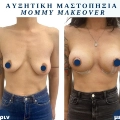 Φωτογραφίες