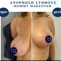 Φωτογραφίες