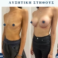 Φωτογραφίες