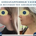 Φωτογραφίες