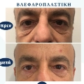 Φωτογραφίες