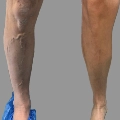 Φωτογραφίες