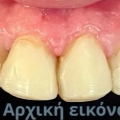 Φωτογραφίες