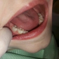 Φωτογραφίες